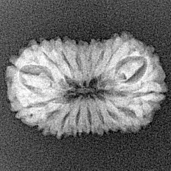 17 Mukhi Rudraksha 22.1mm 1.64gm - Xray