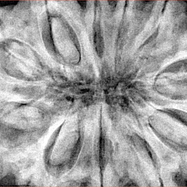 11 Mukhi Rudraksha 38.7mm 12.75gm - Xray