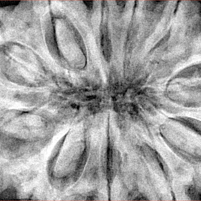 11 Mukhi Rudraksha 38.7mm 12.75gm - Xray