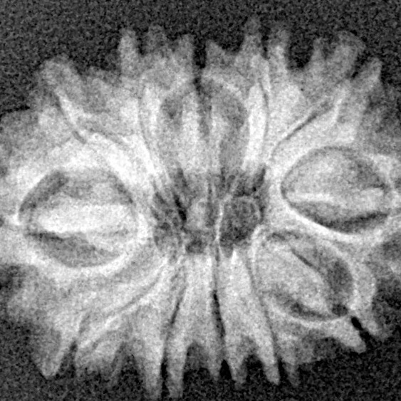 12 Mukhi Rudraksha 22.2mm 2.16gm - Xray