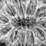 11 Mukhi Rudraksha 37.8mm 10.41gm - Xray