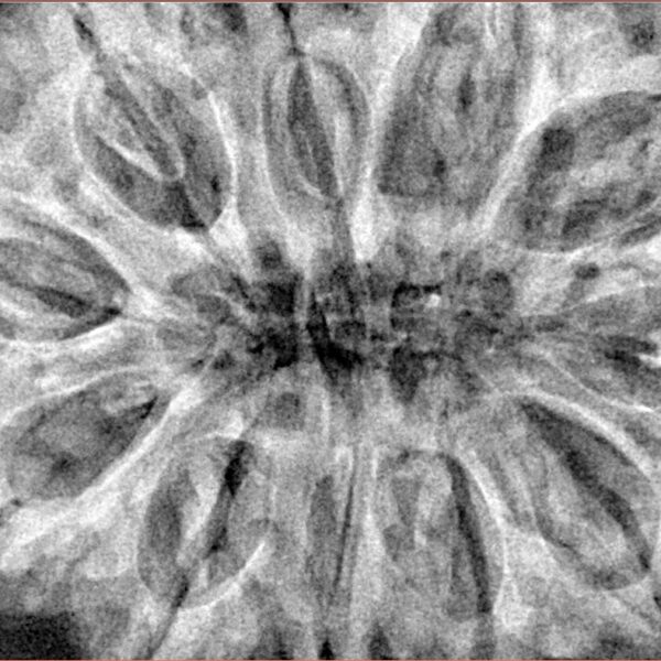 11 Mukhi Rudraksha 37.8mm 10.41gm - Xray