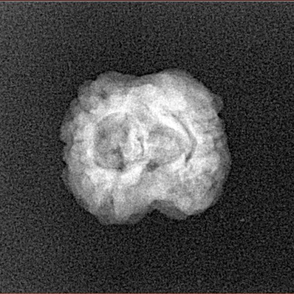 2 Mukhi Rudraksha 21.1mm 1.57gm - Xray