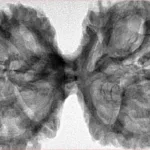 11 MK Gaurishankar 44.5mm 9.85gm - Inverse xray