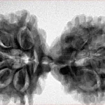9 MK Gaurishankar 40.4mm 7.66gm - Inverse xray