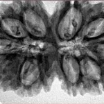 11 MK Gaurishankar 36.4mm 7.51gm - Inverse xray