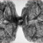10 Mk Gaurishankar 43.4mm 9.48gm - Inverse xray