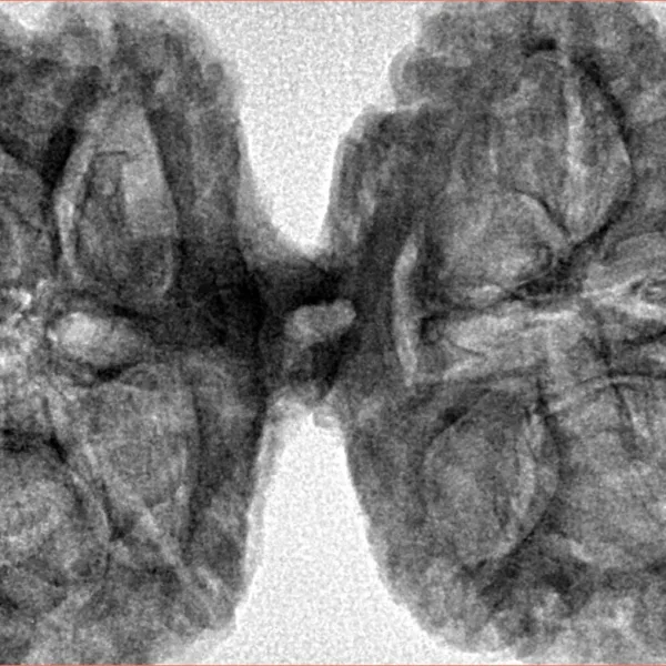 10 Mk Gaurishankar 43.4mm 9.48gm - Inverse xray