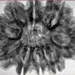 9 Mukhi Rudraksha 31.7mm 6.11gm - Inverse xray