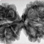 12 MK Gaurishankar 42mm 8.21gm - Inverse xray