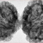 10 Mk Gaurishankar 44.6mm 9.98gm - Inverse xray