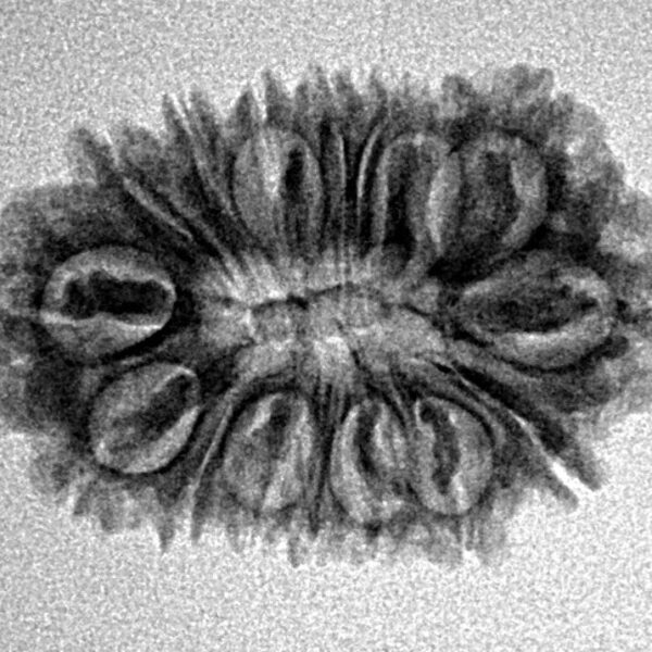 16 Mukhi Rudraksha 25.5mm 2.6gm - Inverse xray