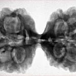 11 MK Gaurishankar 37.6mm 7.6gm - Inverse xray
