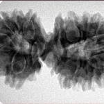 17 MK Gaurishankar 35.9mm 6.06gm - Inverse xray