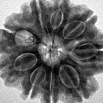 9 Mukhi Rudraksha 25.9mm 5.41gm - Inverse xray