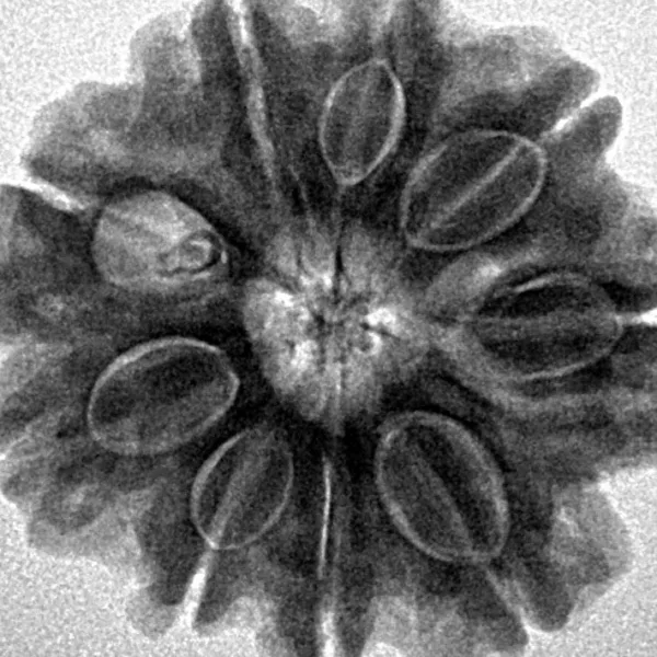 9 Mukhi Rudraksha 25.9mm 5.41gm - Inverse xray