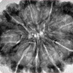 9 Mukhi Rudraksha 33.8mm 6.08gm - Inverse xray