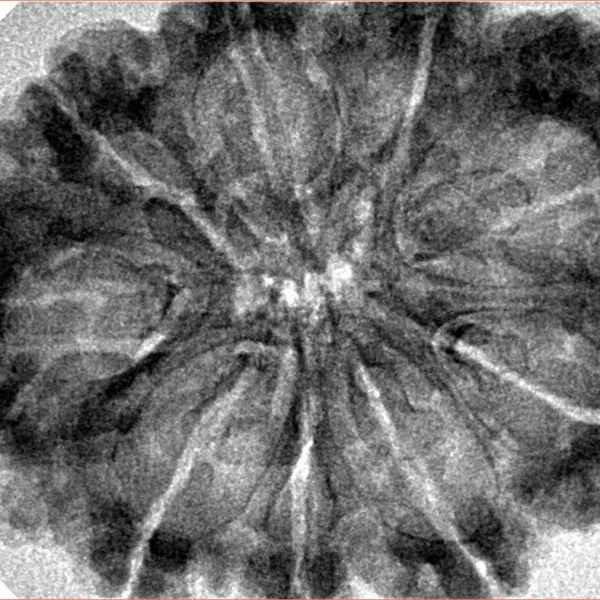 9 Mukhi Rudraksha 33.8mm 6.08gm - Inverse xray