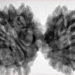 12 MK Gaurishankar 43.2mm 9.79gm - Inverse xray