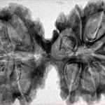 10 Mk Gaurishankar 39.8mm 8.83gm - Inverse xray