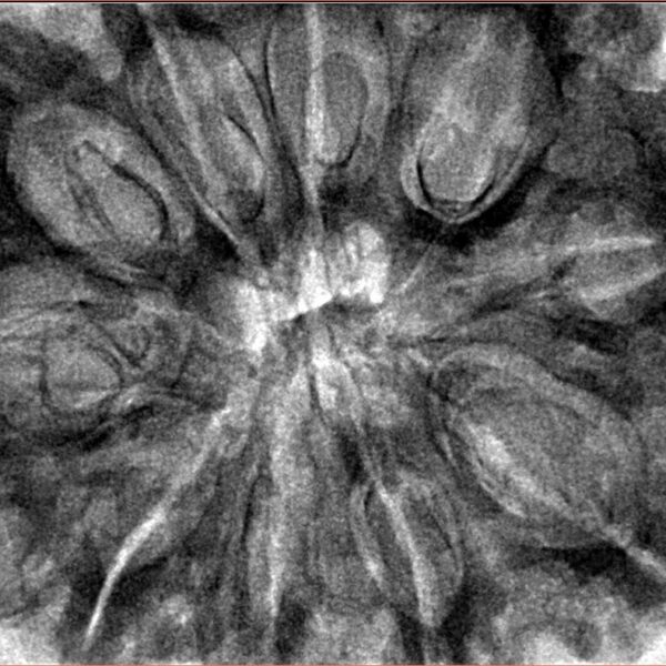 10 Mukhi Rudraksha 36.8mm 10.37gm - Inverse xray