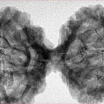 10 Mk Gaurishankar 43.6mm 8.39gm - Inverse xray