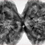 10 Mk Gaurishankar 43mm 11.33gm - Inverse xray