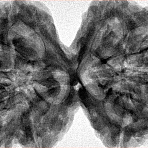 10 Mk Gaurishankar 43mm 11.33gm - Inverse xray