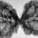 9 MK Gaurishankar 44.6mm 7.84gm - Inverse xray