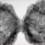 10 Mk Gaurishankar 47mm 9.6gm - Inverse xray