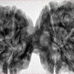 9 MK Gaurishankar 42.6mm 10gm - Inverse xray