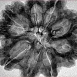 9 Mukhi Rudraksha 29.5mm 5.73gm - Inverse xray