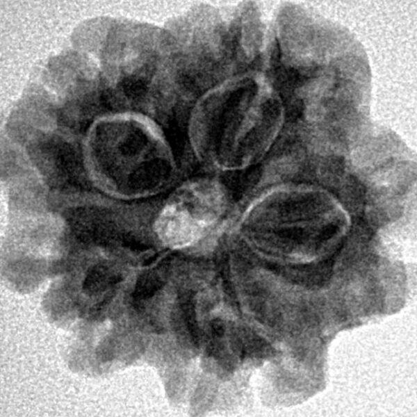 1MK(Underdeveloped) 22.6mm 3.54gm - Origin: Nepal - Inverse xray