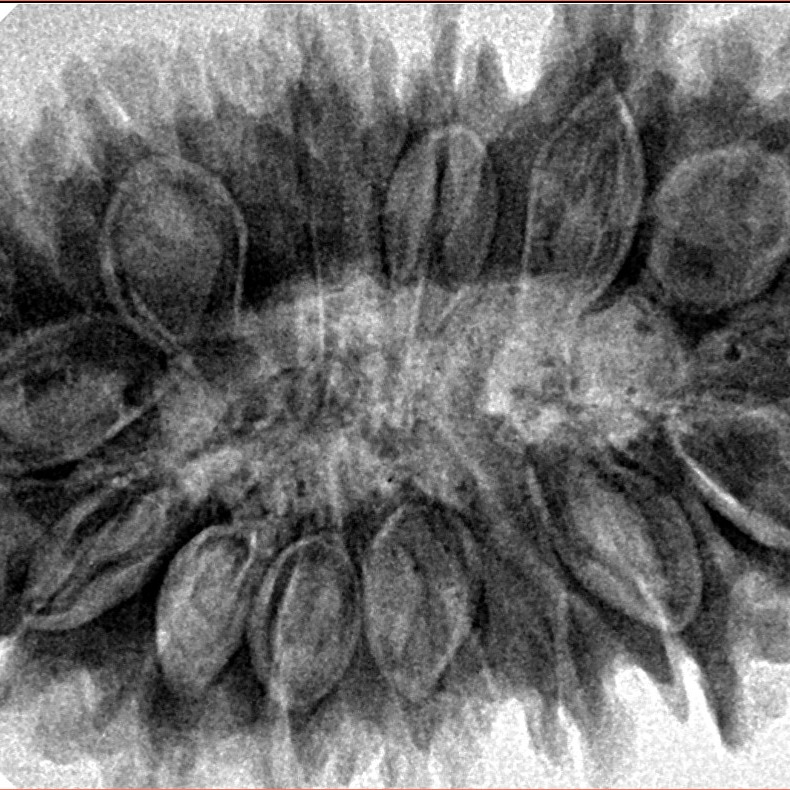 16 Mukhi Rudraksha 38.4mm 8.13gm - Inverse xray