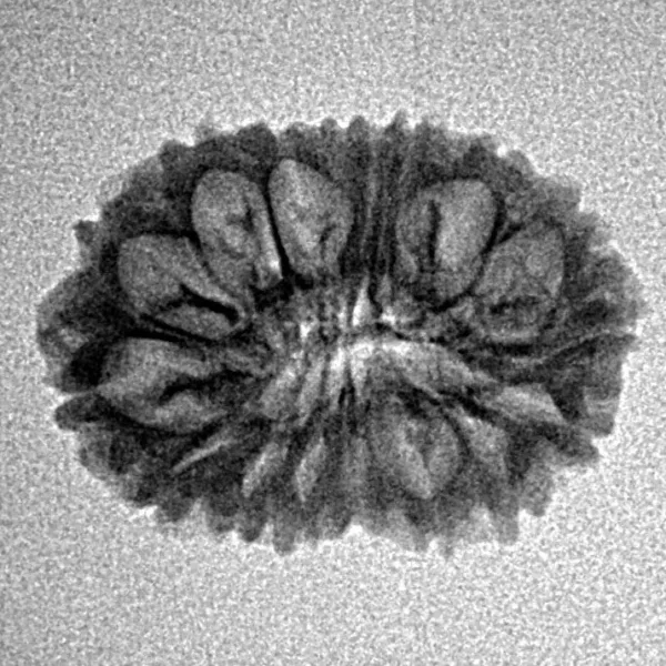 16 Mukhi Rudraksha 21.1mm 1.62gm - Inverse xray