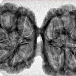 12 MK Gaurishankar 40.1mm 8.16gm - Inverse xray