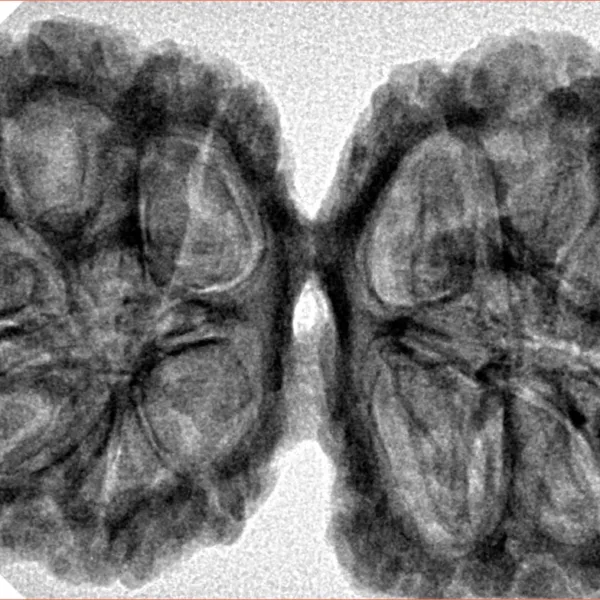 12 MK Gaurishankar 40.1mm 8.16gm - Inverse xray