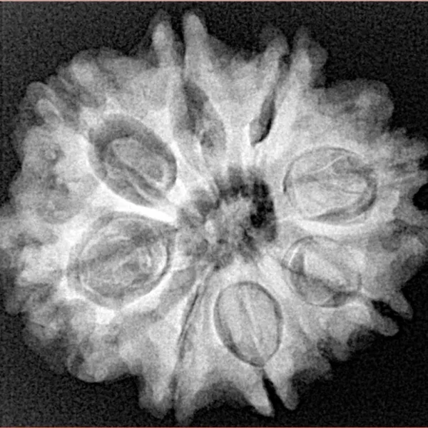 9 Mukhi Rudraksha 26.7mm 5.19gm - Xray