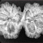 10 Mk Gaurishankar 35.9mm 6.94gm - Xray