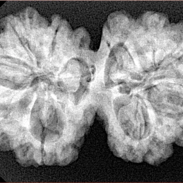 10 Mk Gaurishankar 35.9mm 6.94gm - Xray
