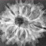 9 Mukhi Rudraksha 26.4mm 2.77gm - Xray