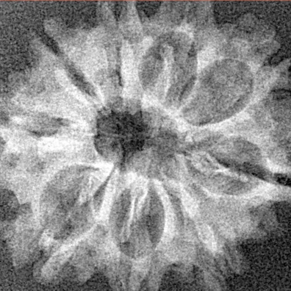 9 Mukhi Rudraksha 26.4mm 2.77gm - Xray