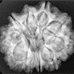 10 Mukhi Rudraksha 26.5mm 5.8gm - Xray
