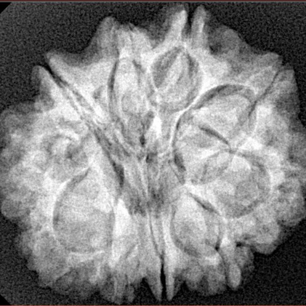 10 Mukhi Rudraksha 26.5mm 5.8gm - Xray