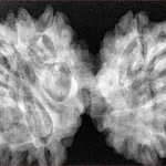12 MK Gaurishankar 43.2mm 9.79gm - Xray