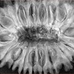 18 Mukhi Rudraksha 37.8mm 8.55gm - Xray