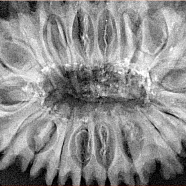 18 Mukhi Rudraksha 37.8mm 8.55gm - Xray