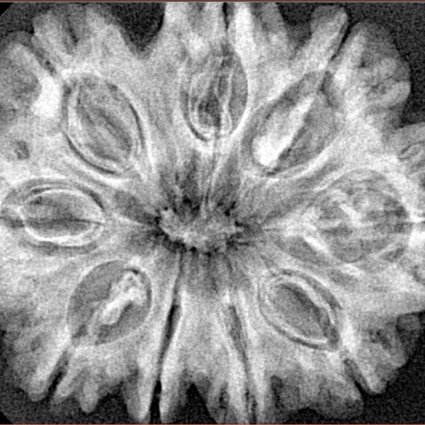 9 Mukhi Rudraksha 31.4mm 6.41gm - Xray