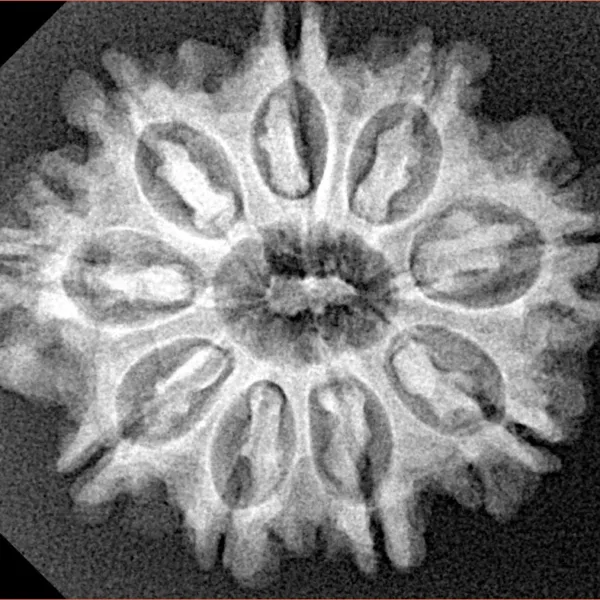 9 Mukhi Rudraksha 26.9mm 4.45gm - Xray