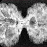 10 Mk Gaurishankar 38.6mm 7.47gm - Xray